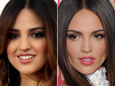 10 Telenovela stars’ DRAMATIC plastic surgery transformations